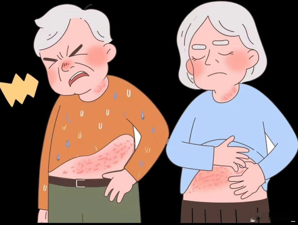 缠腰龙容易缠上糖尿病糖尿病患者要警惕！专家提醒，高血糖会削弱免疫力，让带状疱疹（