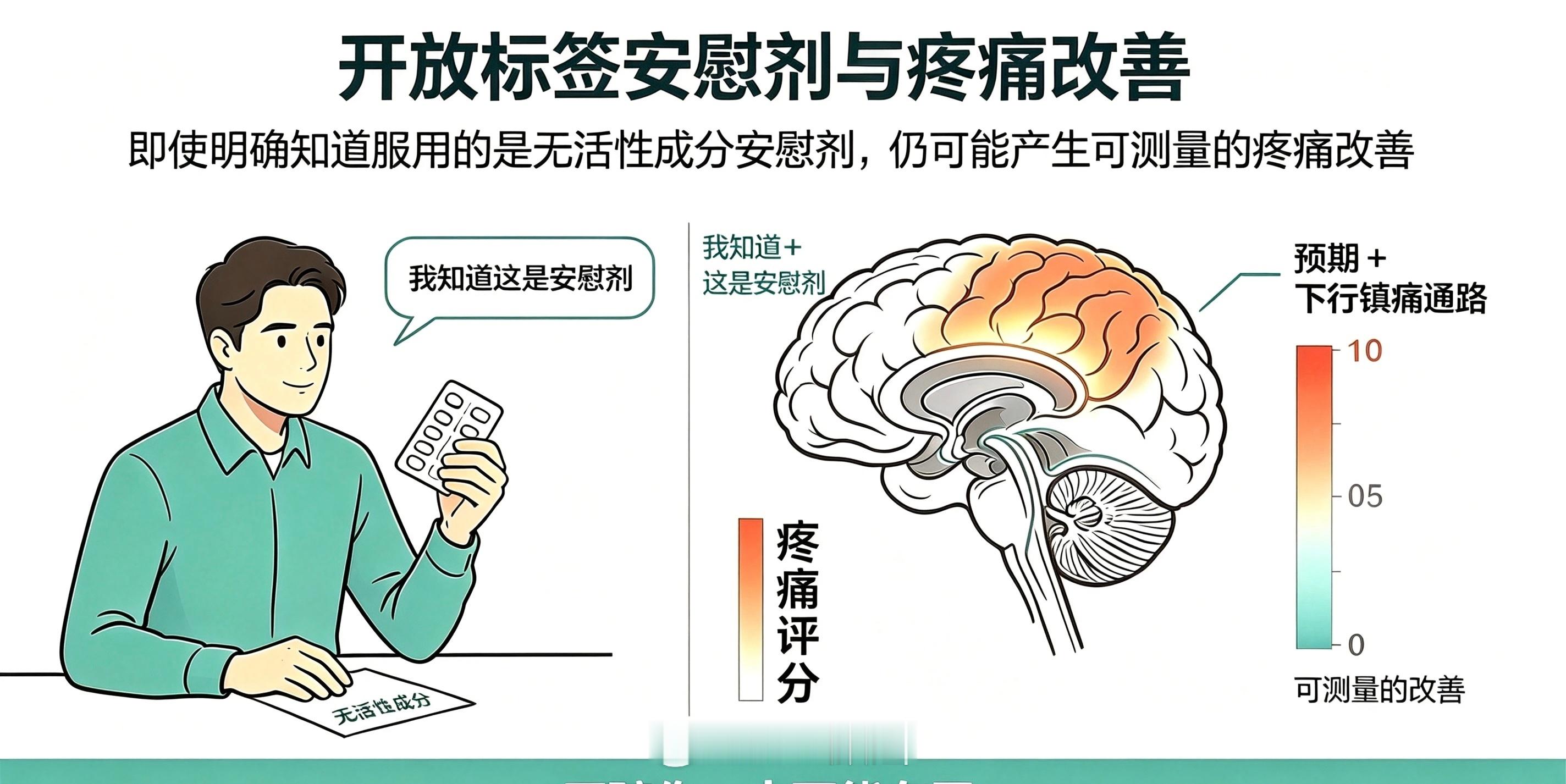 安慰剂效应常被当成“骗出来的效果”，但2021年《疼痛》期刊的一项系统综述发现：