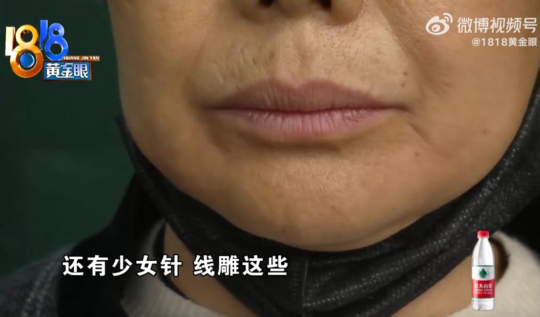 杭州61岁雷大姐长期受抑郁困扰，被微商恶意诱导至某医美机构，三次消费累计119万