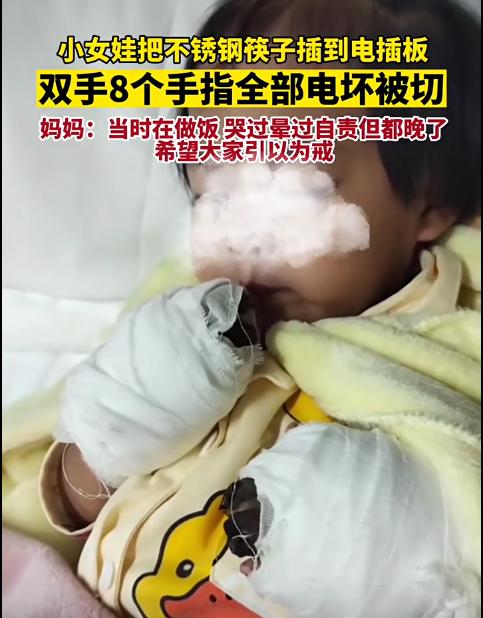 小女孩因为好奇将不锈钢筷子插进插排，8根手指全部被电坏，被迫被切掉。

孩子的妈