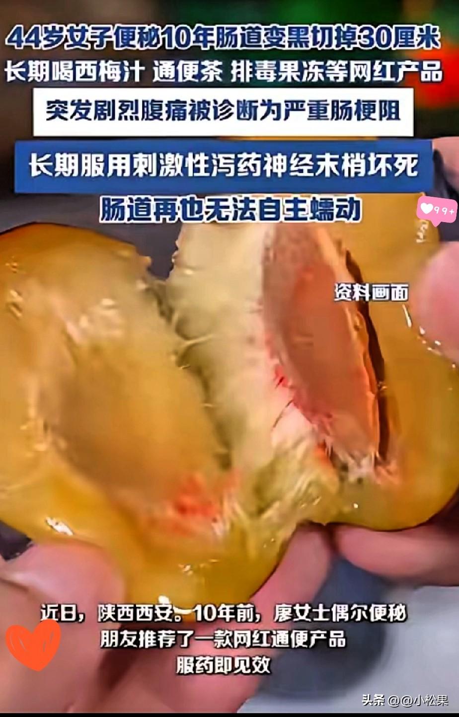 悲剧还是发生了！陕西一女子便秘10年，天天靠通便茶、西梅汁、通便果冻解决问题，最