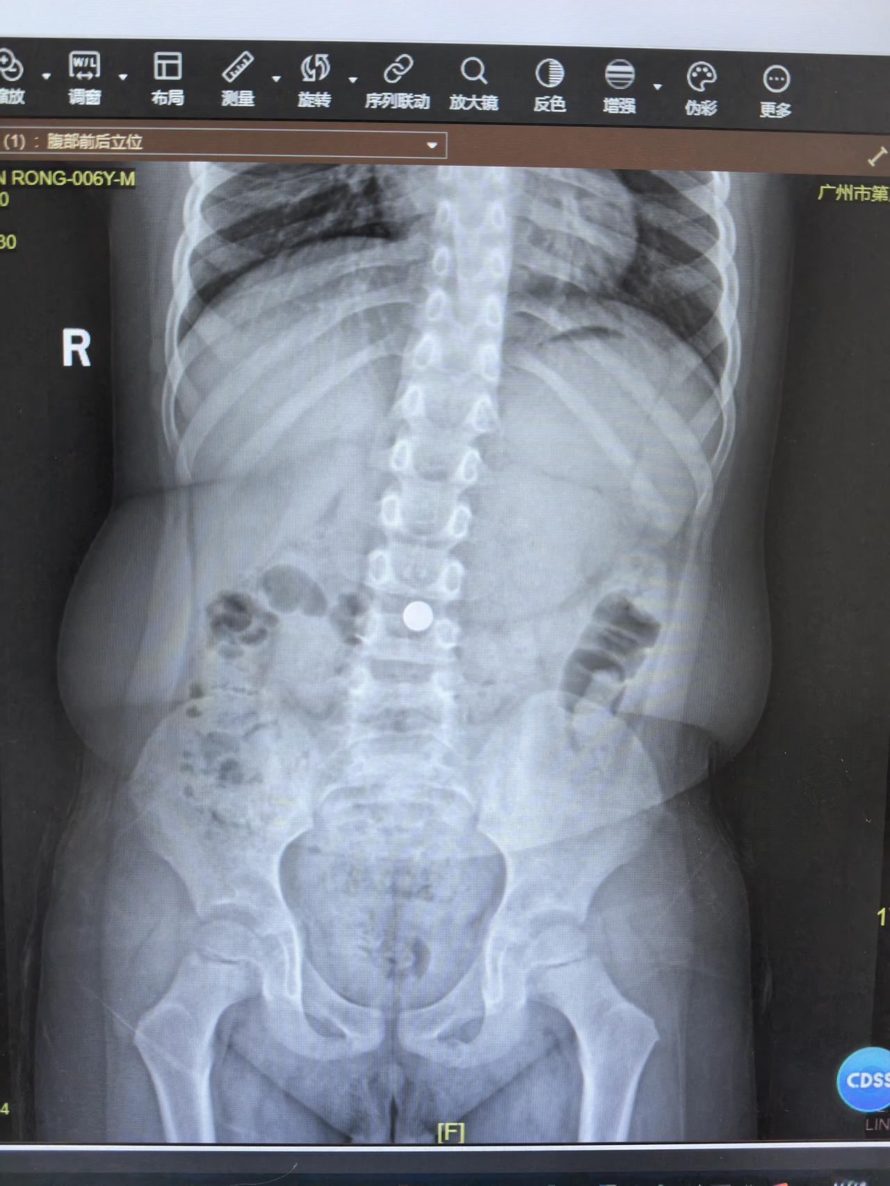 你们猜猜

这个小家伙

把什么吃到肚子里去了？