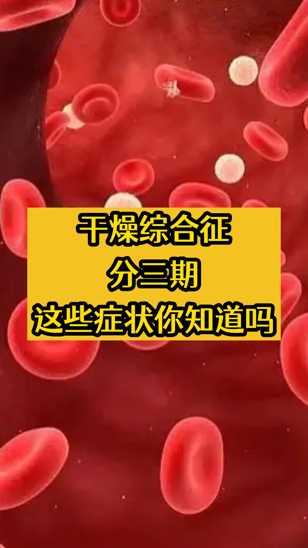 大家好我是韦云医生，今年60多岁了，从事血液疾病已经40多年了，今天跟...
