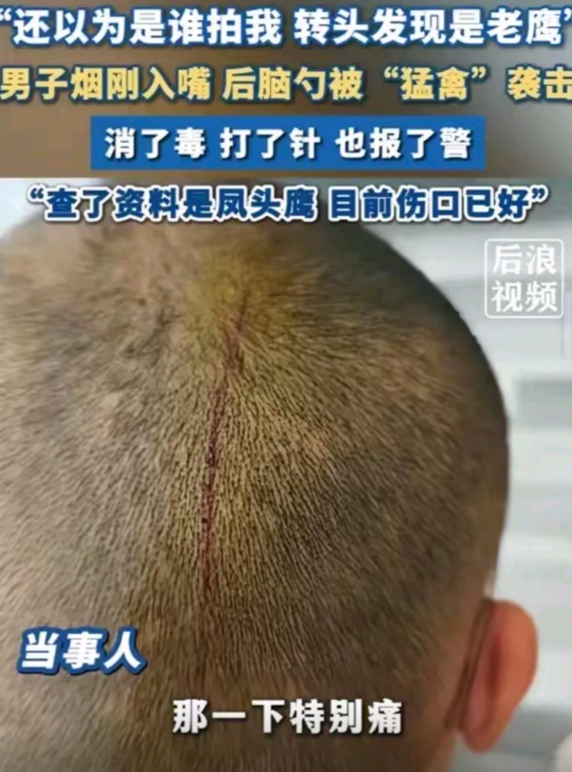 你听说过抽根烟都能被老鹰袭击的事儿吗？苏州一位大哥就真遇上了这种离奇经历，本来只