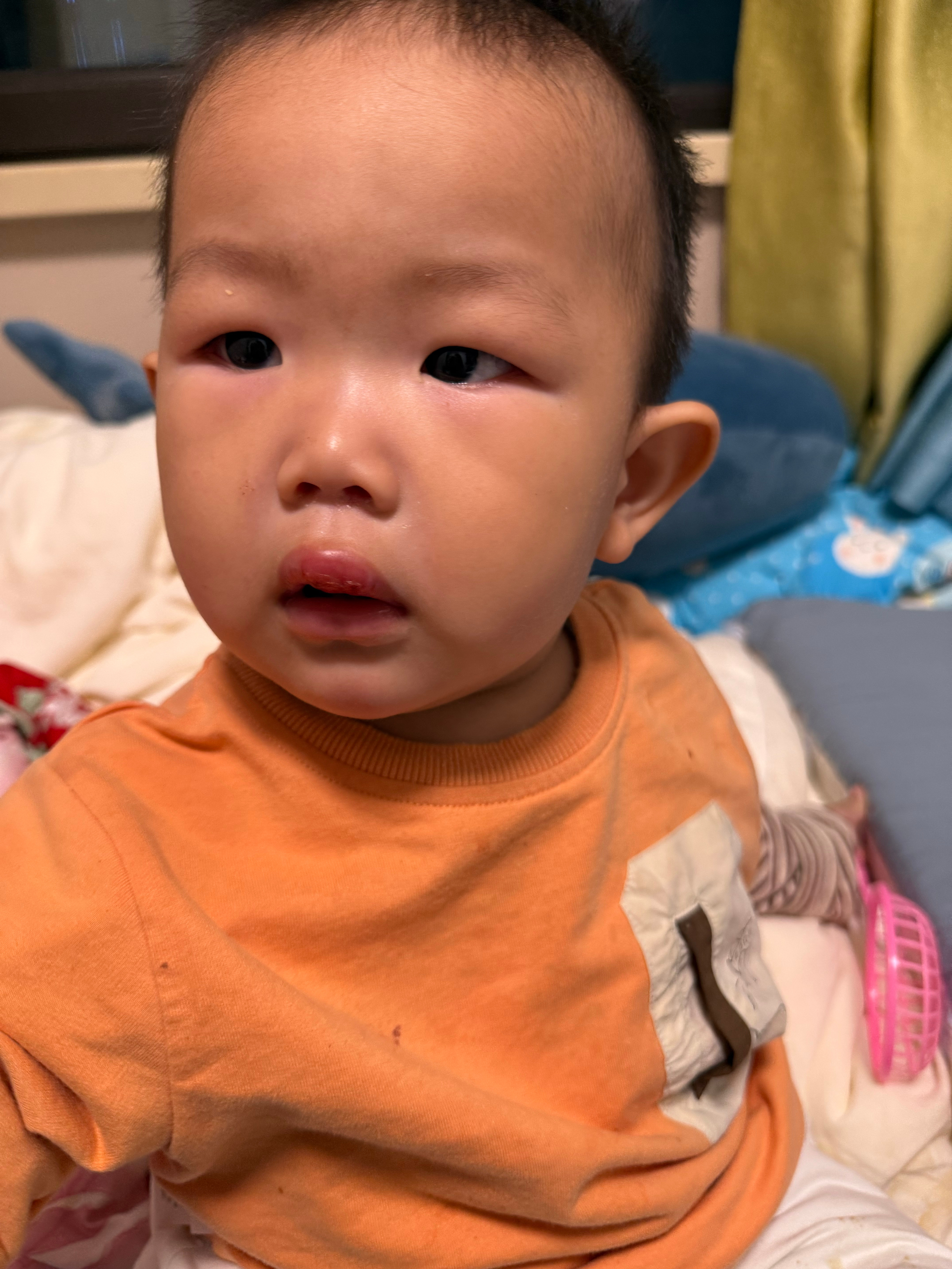 出去吃饭回来天塌了，小宝从车子上掉下来了嘴磕肿了，成辛普森了