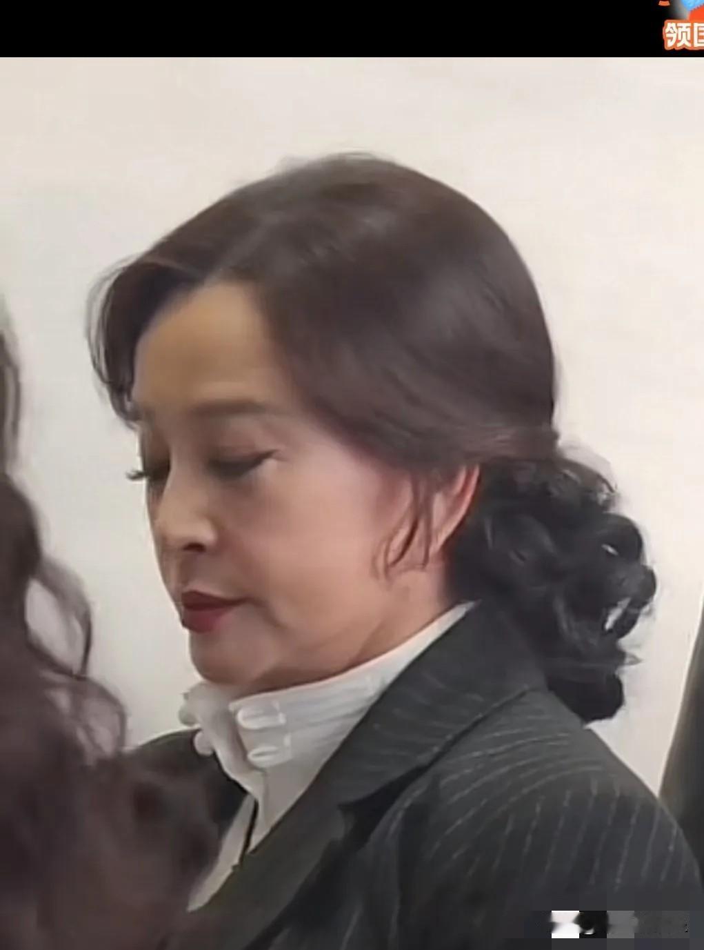 离开美颜滤镜，这才是刘晓庆真实的皮肤状态，
各种衰老的皱纹垮脸，医美痕迹明显等问