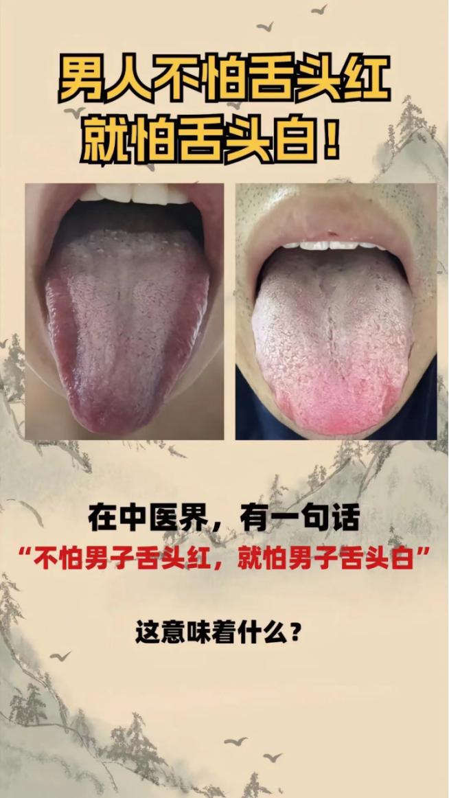 公益舌诊，你发我看，现出结果，第31天！
 
要求：尽量拍完整；不开美颜；不吃染