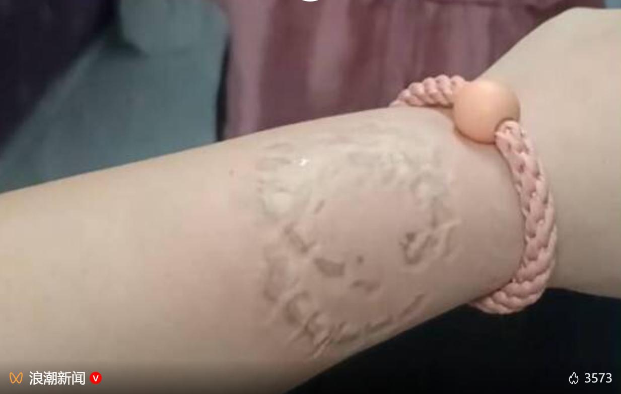 出门坐火车遇到霸座本就闹心，江苏的李女士不仅遇上有人霸占自己卧铺，争执过程中手腕