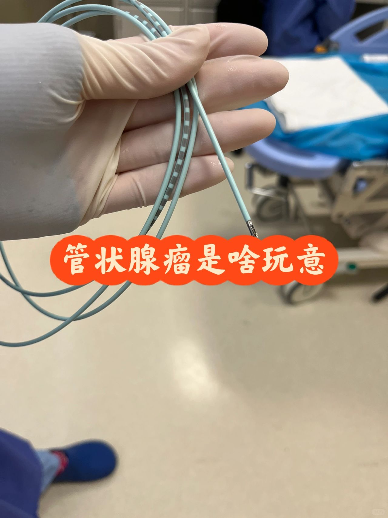 管状腺瘤要紧吗