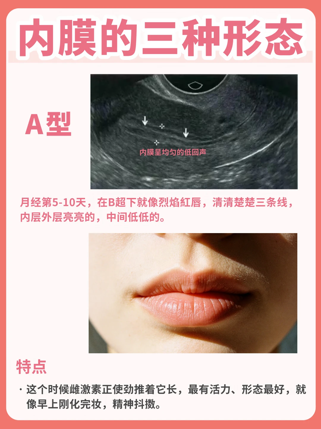 排卵期前看到C型内膜，先别急着给自己判分
