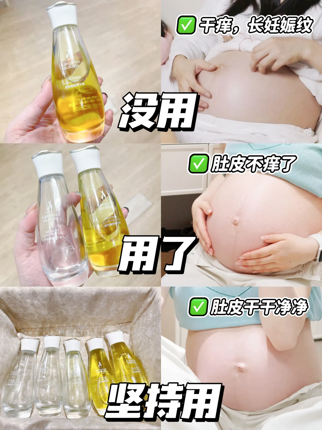 老天奶！怎么没早点发现这个神仙妊娠油！