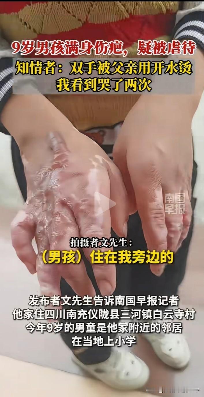 四川南充男子打工回家，发现附近邻居的9岁男孩伤痕累累，疑似被父亲虐待，当地政府已