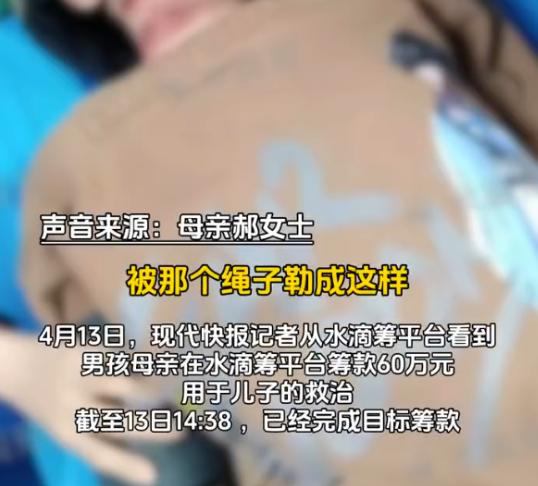 被绳锁喉男孩已完成60万元筹款，家属表示感谢，男孩母亲曾表示善款将全部用于治疗。
