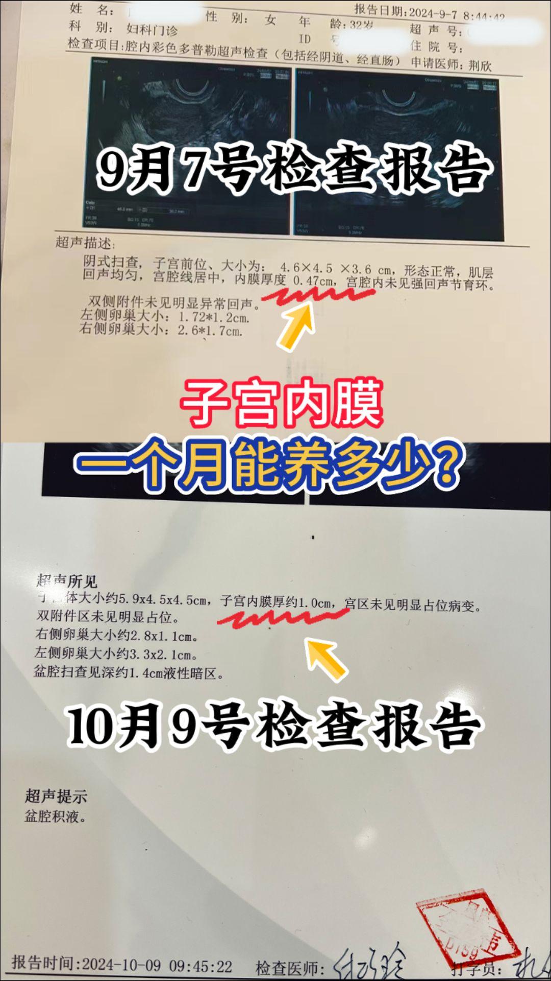 子宫内膜一个月能养多少。