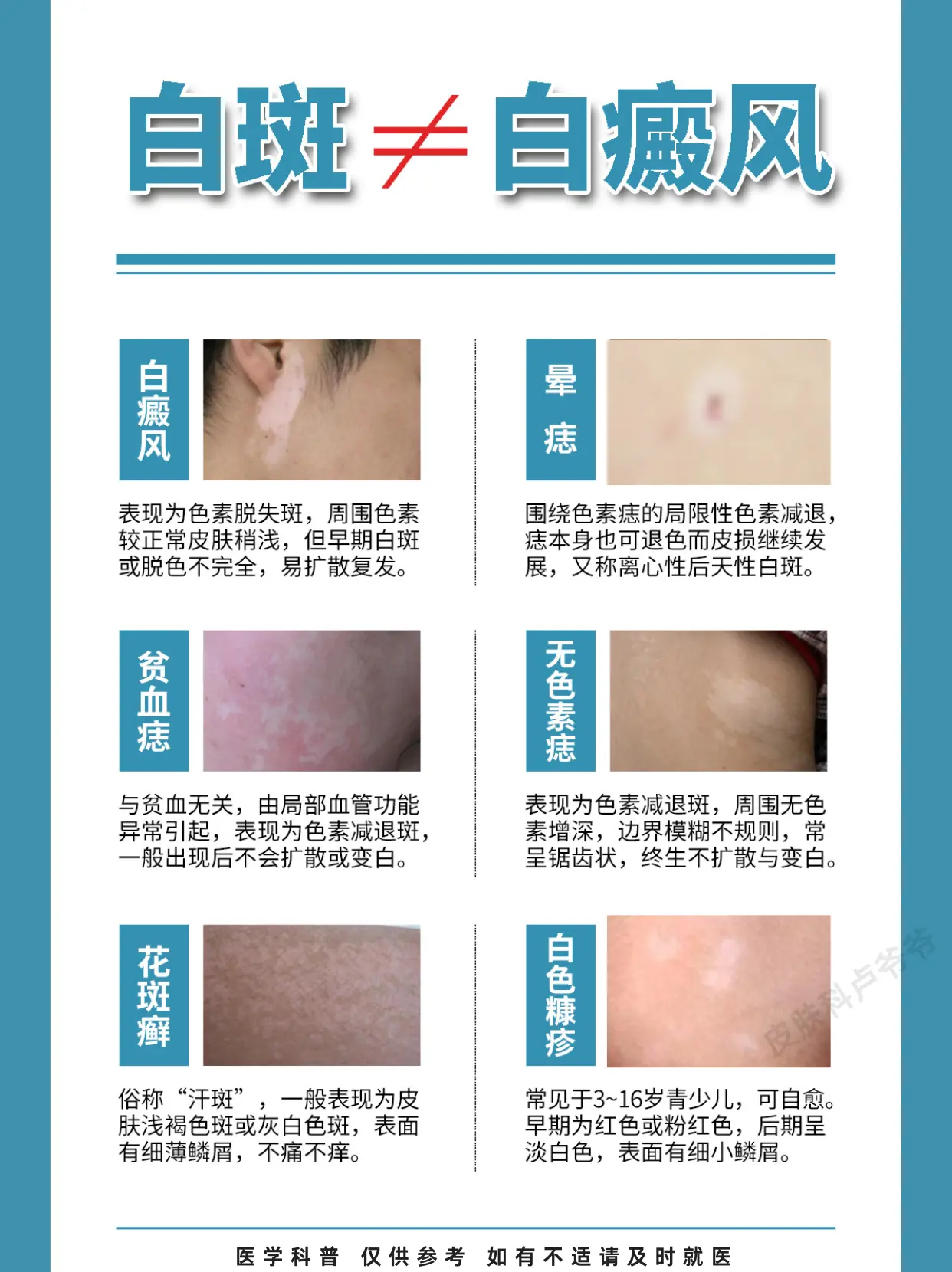常见白斑教你辨别