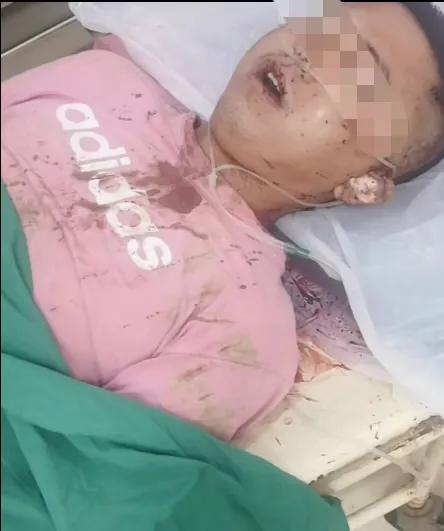 四川籍男子易某在老挝身亡，87年生人，37岁，看遗体上半身有斑斑血迹，据传是被人