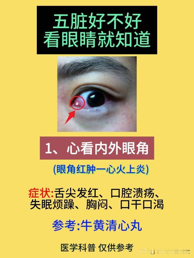 五脏好不好,看眼睛就知道!
1.心看内外眼角——眼角红肿，心火上炎
2.肝看黑眼