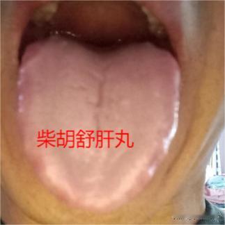 中老年人有没有病，看放屁就知道了，中医教你观屁知健康
1.响屁、味道不重
伴有腹