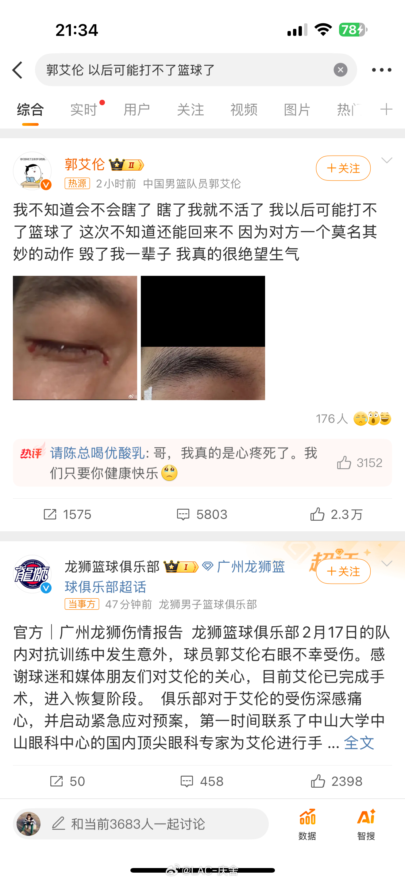 郭艾伦 以后可能打不了篮球了 太能感同深受了，虽然运动受伤是家常便饭，但是眼睛是