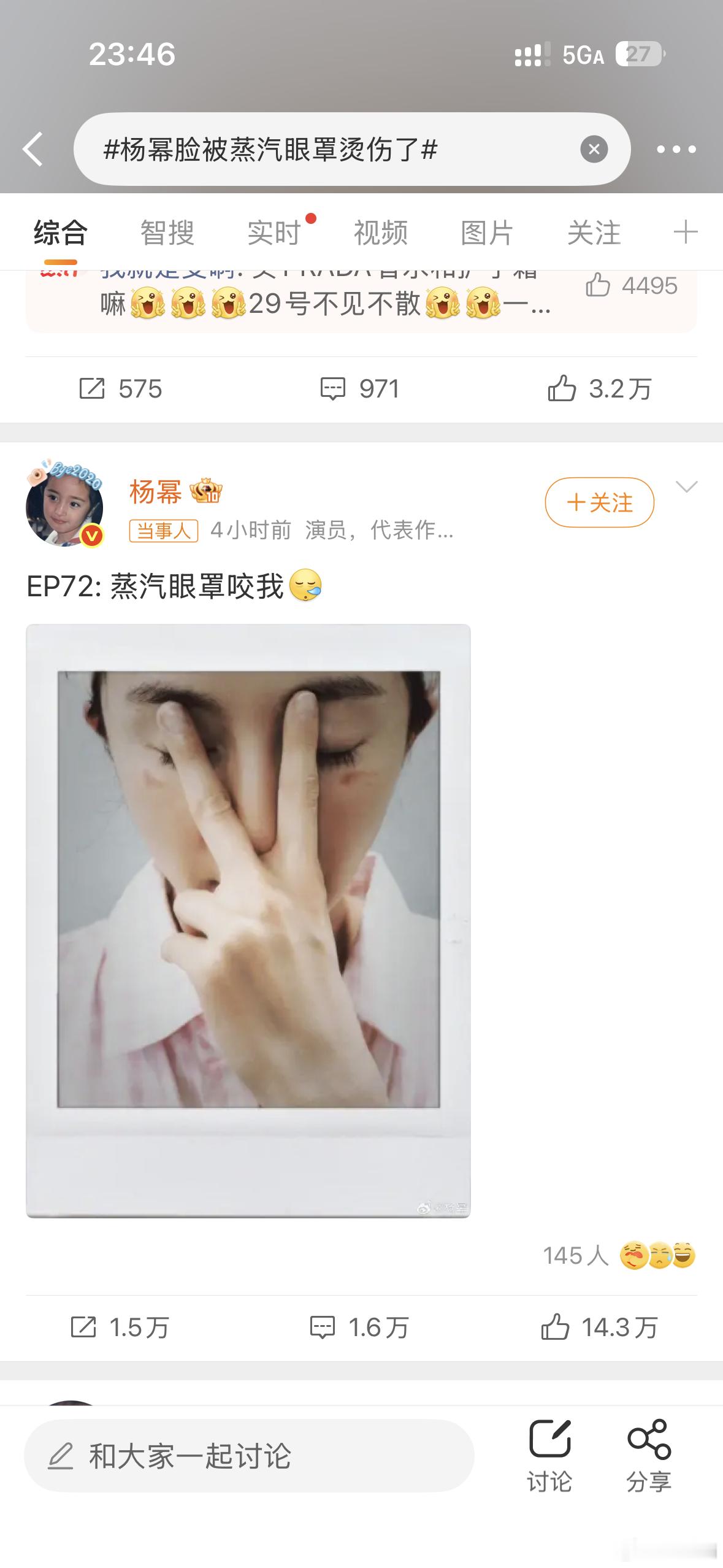 杨幂脸被蒸汽眼罩烫伤了杨幂好火啊发个微博直接爆了