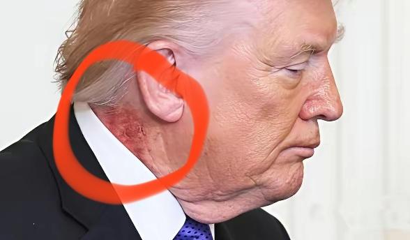 万斯的机会是不是快来了？

79岁的特朗普近来健康争议不断，继手部瘀青、腿部慢性