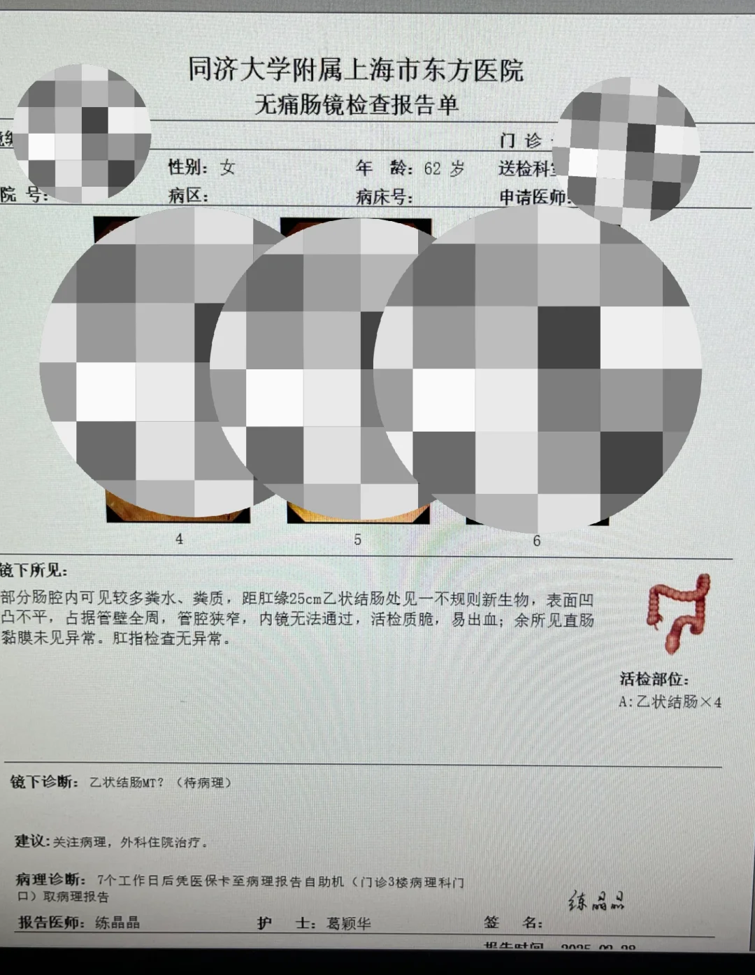 这就是要让父母胃肠镜体检的原因