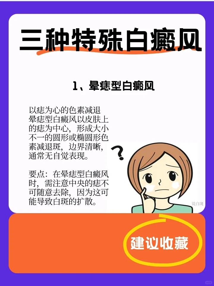 三种特殊的白癜风🔍早期白斑表现也不同