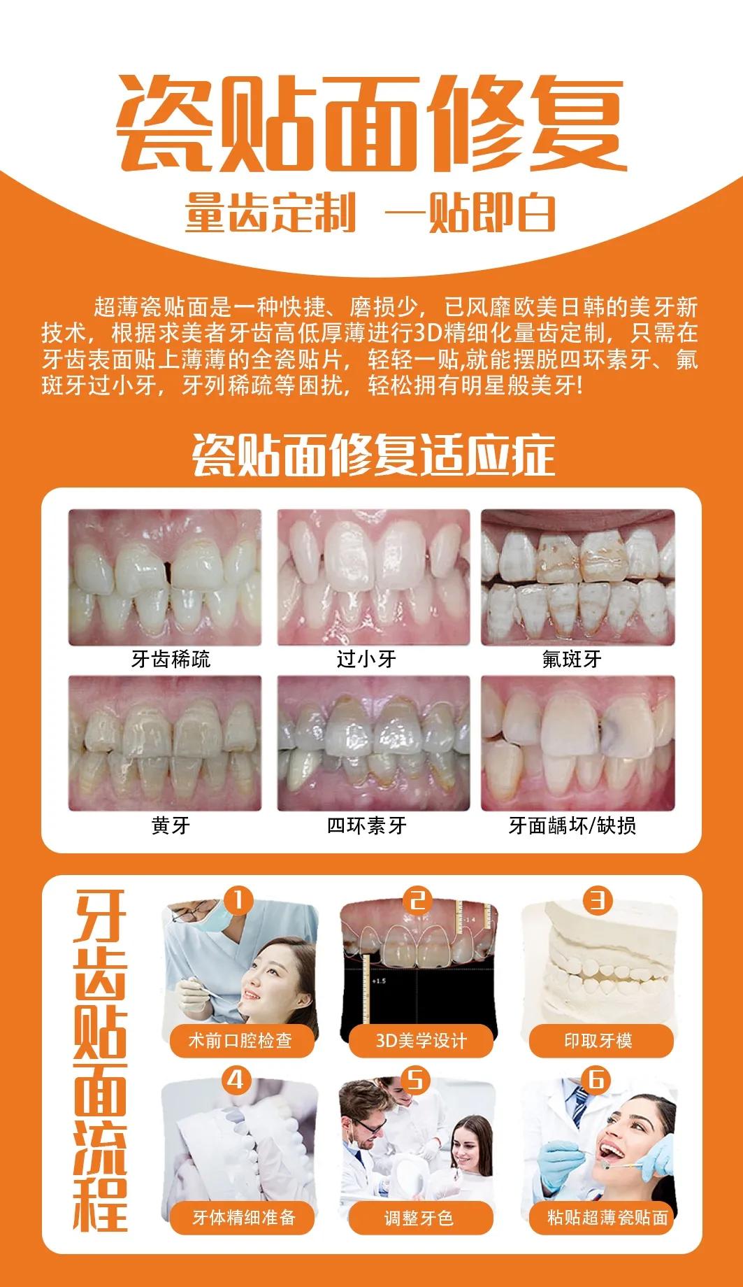 瓷贴面有必要吗