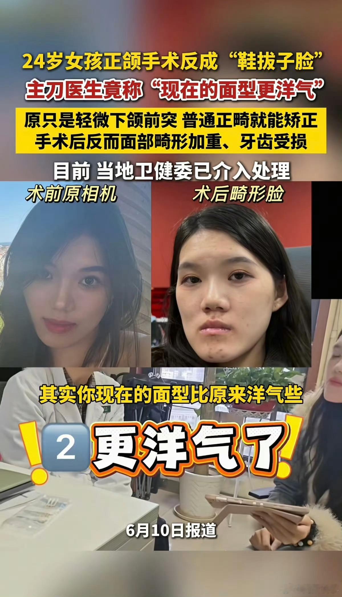 阎肃观察肃言肃语 【女孩整成鞋拔子脸医生称喜欢这种面型】鞋拔子脸维权女孩称修复至
