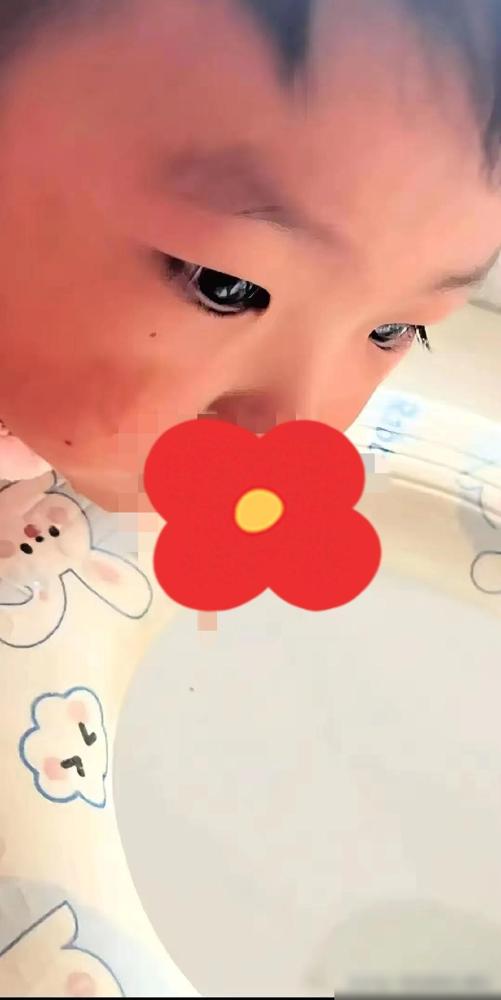 震惊了！河南周口，七岁男孩前后连着高烧，半夜枕头上全是鼻血，妈妈抱着去市里儿童医