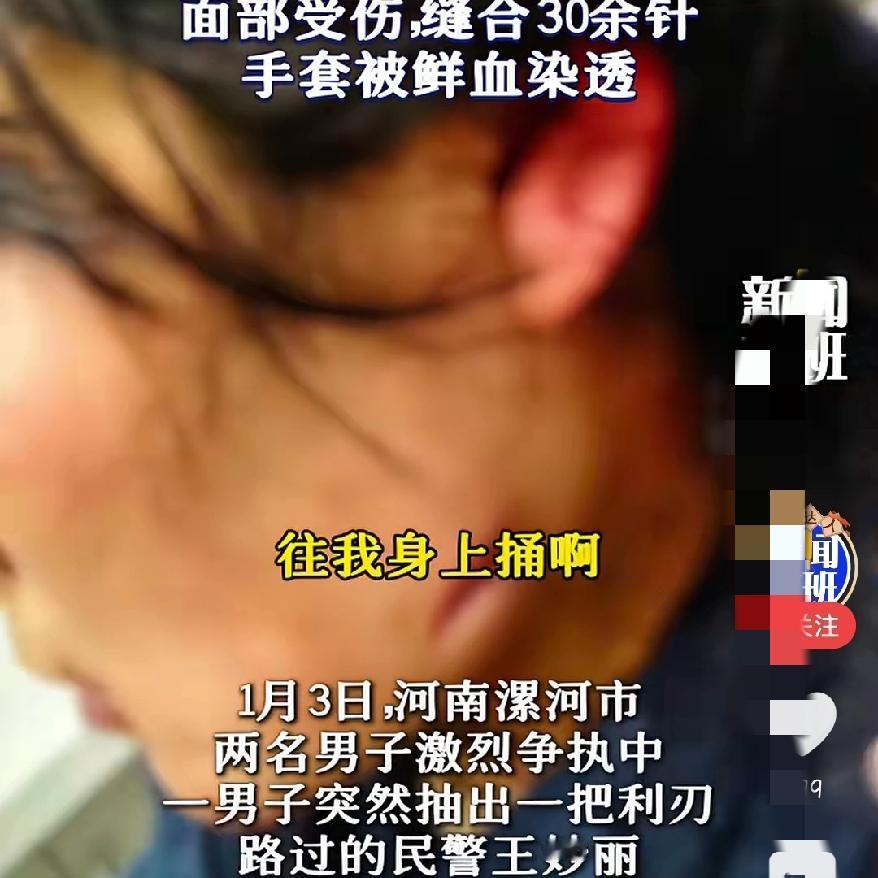 人民好警察
漯河女民警徒手制刀徒缝30针！
这抹巾帼红，才是最动人的安全感！
 