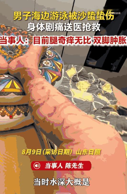 万万没想到！山东日照，男子下海游泳，谁能想到在浅水区突然遭遇了水下“隐形杀手”，