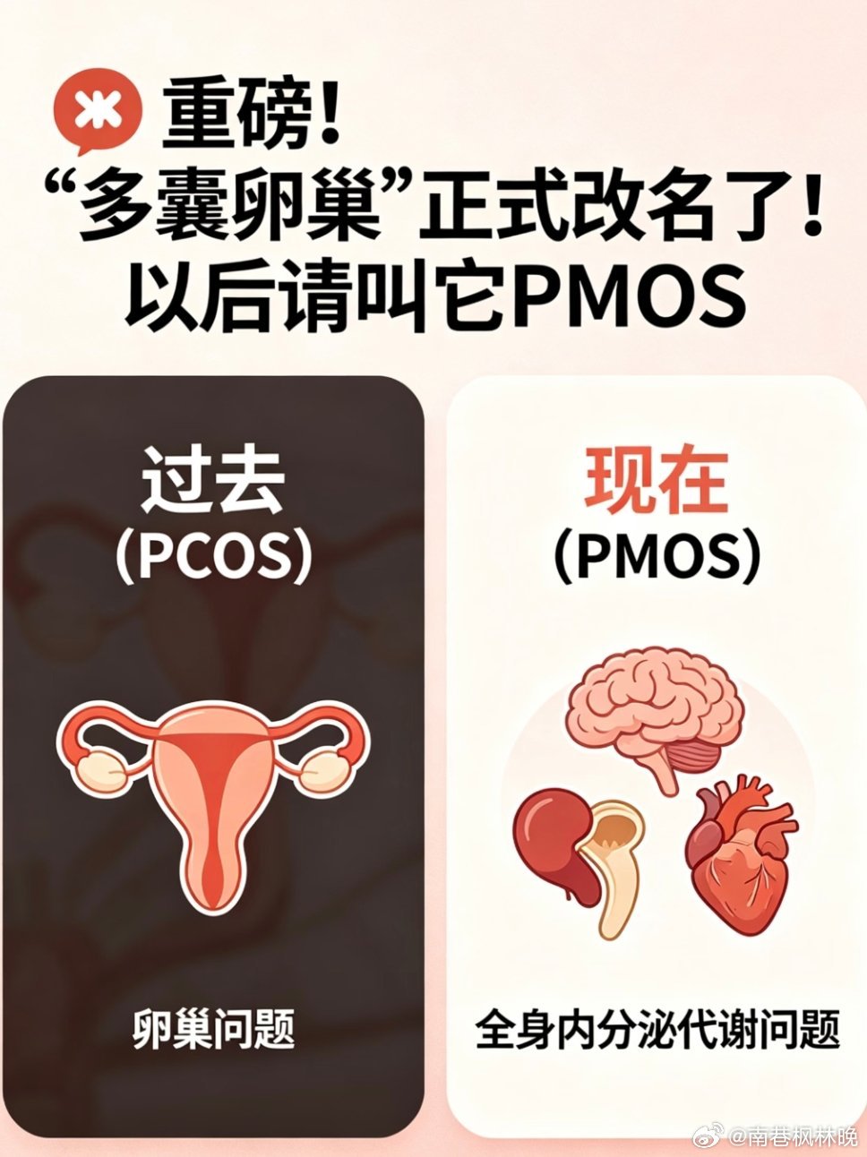 多囊卵巢综合征正式更名新名字真的太贴心了，多内分泌代谢卵巢综合征PMOS，直接去