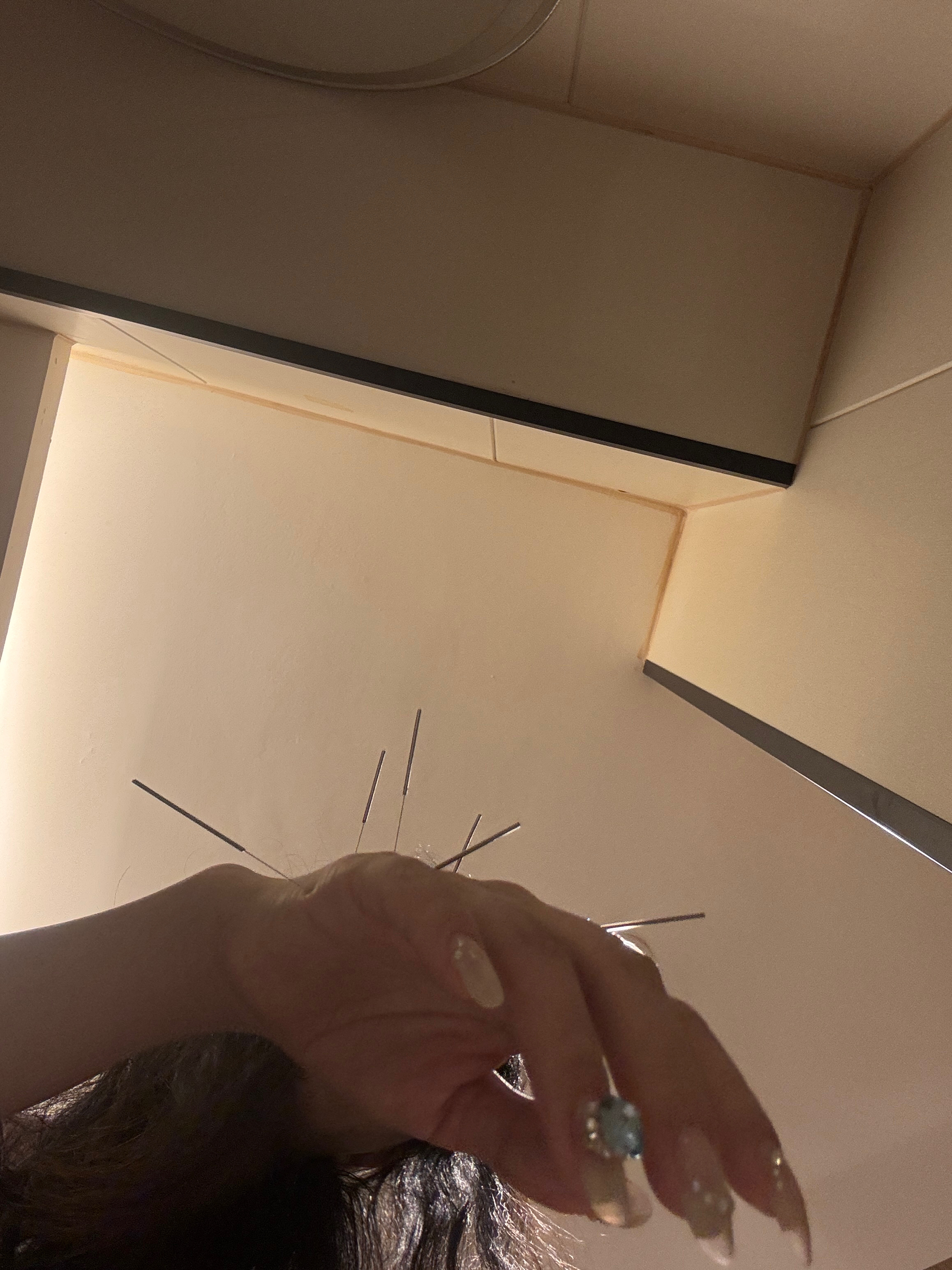 这个扎针的地方！是我跟薛老师去年五一去杨浦那边的公园玩偶尔发现的意外的里面的师傅