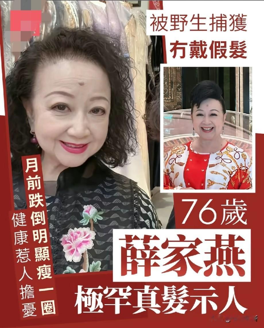 76岁薛家燕罕见卸下假发，野生实拍状态曝光，早前跌倒消瘦引网友牵挂
 
港圈老牌