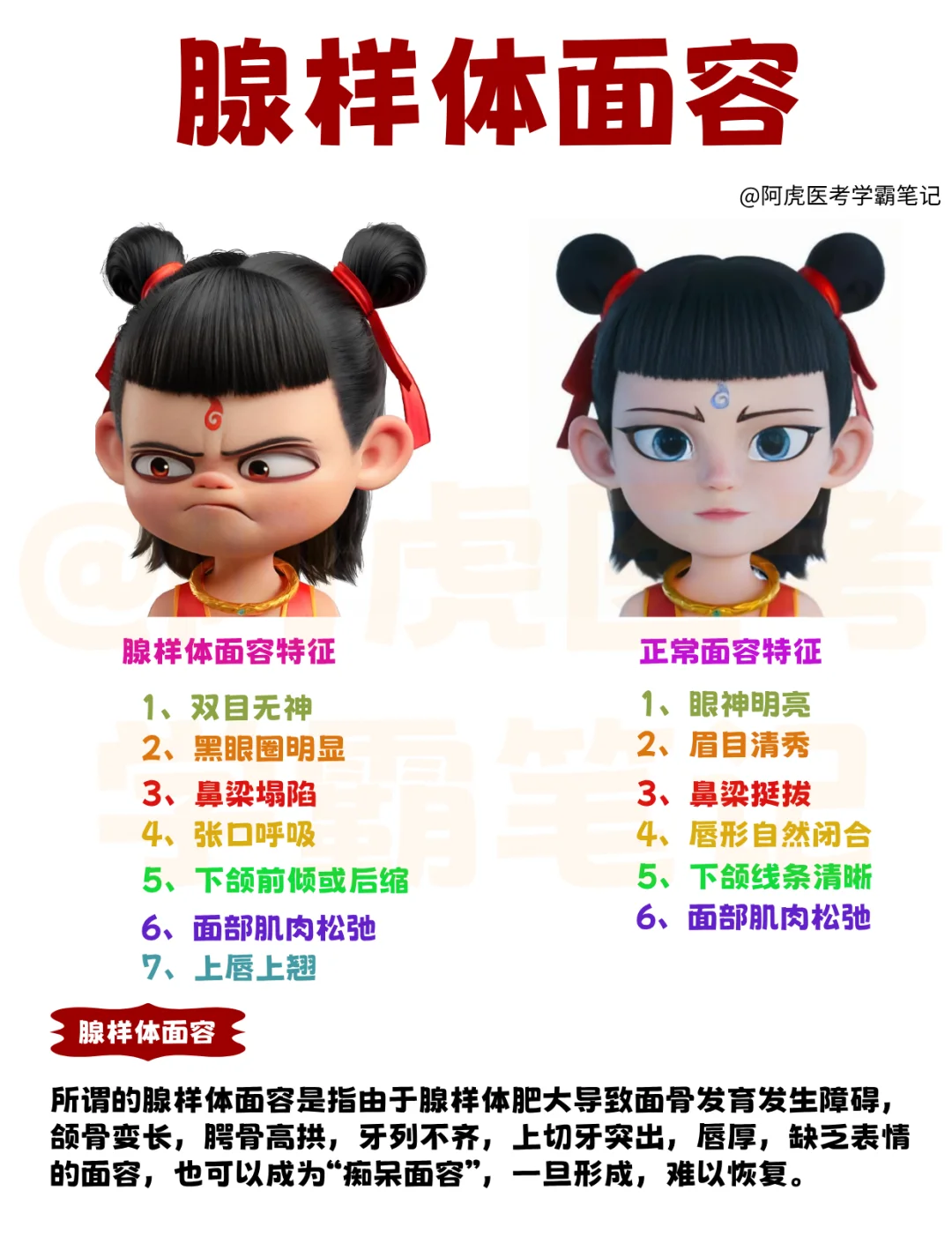 医学生笔记📒｜腺样体面容👆