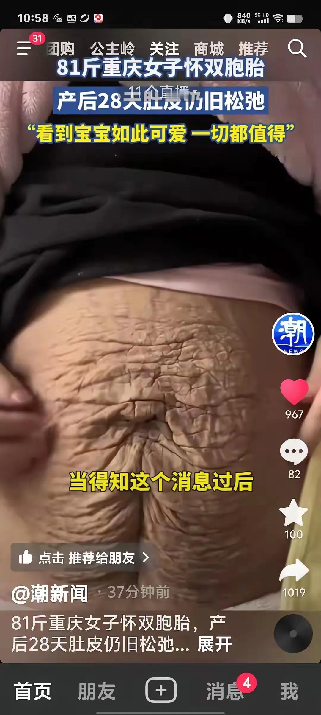 “看谁还敢觉得女人生孩子是小事！”重庆一女子生了双胞胎，但孩子出生后，女子的肚子
