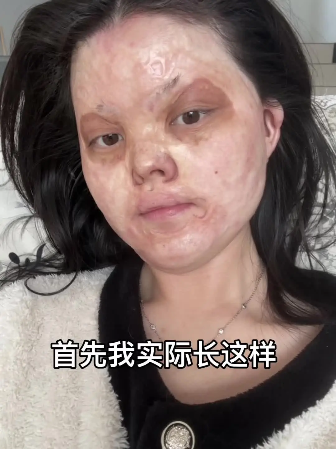 反差