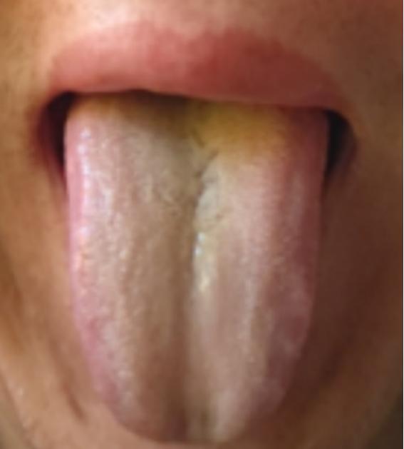 别管多难搞的肾虚，必先打通这两处，应对厚腻苔，肾虚，效如桴鼓！
 
肾虚，其实不