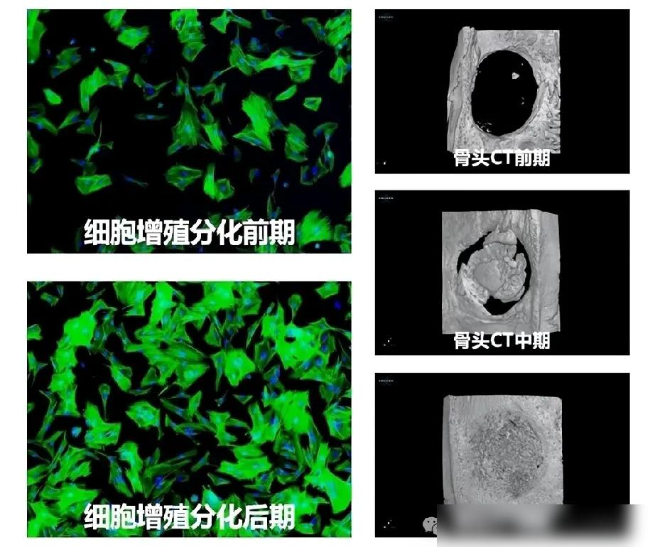 《哪吒2》票房刚破143亿，湖北科学家就整了个大活！他们竟用莲藕3D打印“人造骨