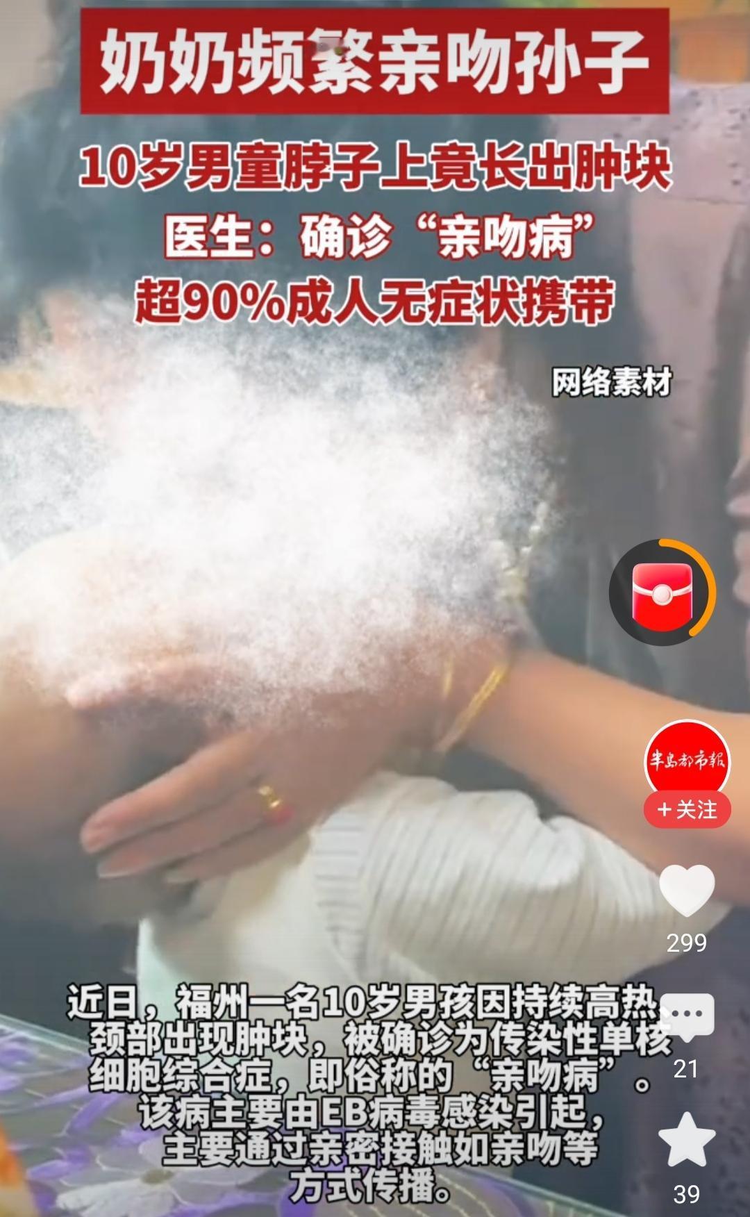 “亲吻病”在医学上通常指由EB病毒感染引起的传染性单核细胞增多症，对儿童健康的影