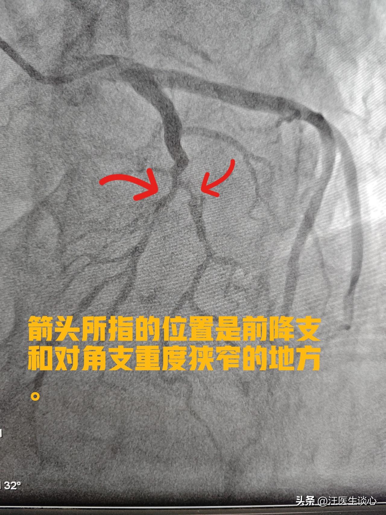 代码可以重写，健康不能重来。38岁的程序员，长期熬夜写代码，平常也不怎么运动，体