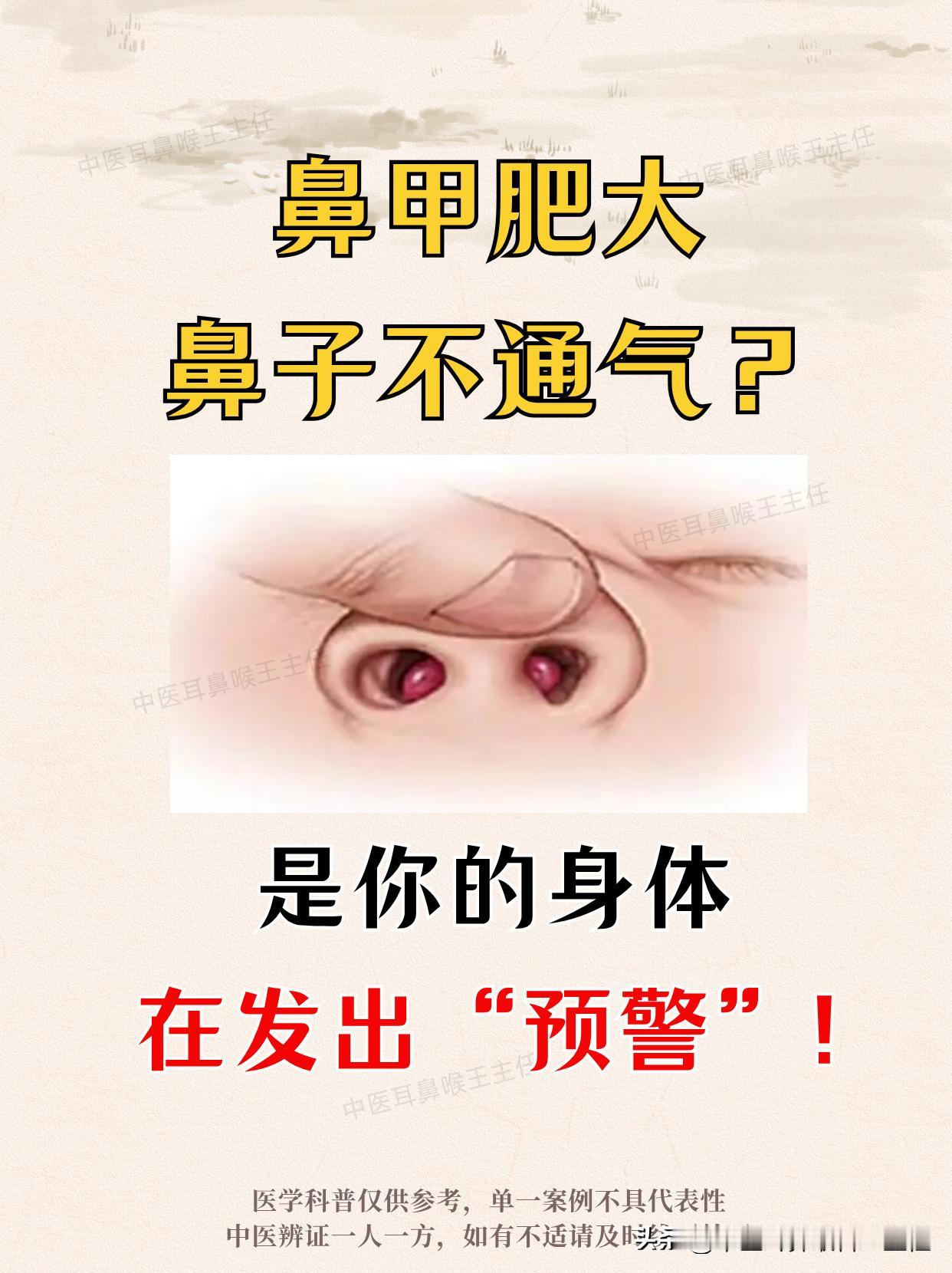 鼻甲肥大，鼻塞不通气，其实都是鼻炎引起！