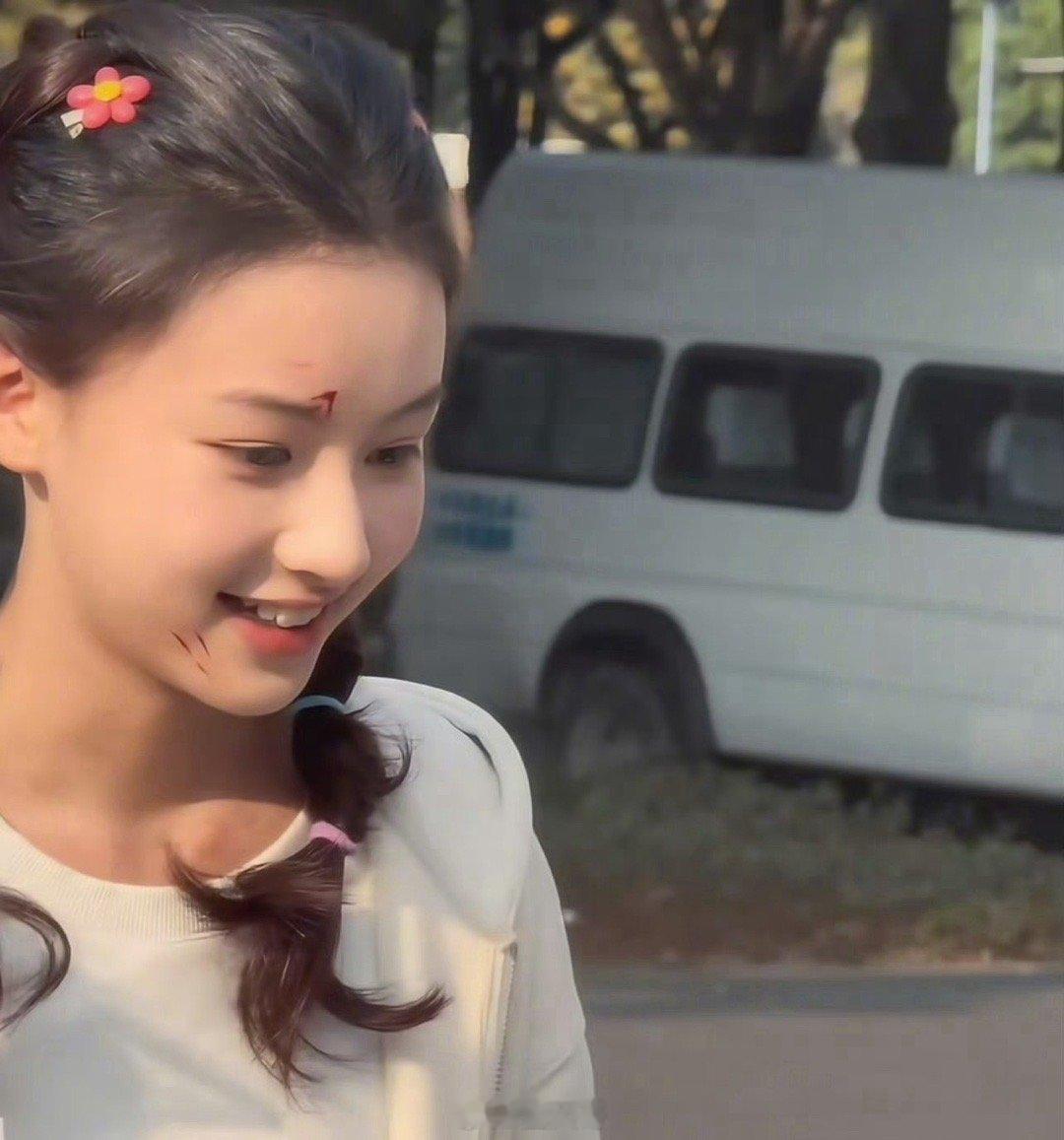 赵钰琪新剧受伤妆路透不愧是全网公认的元气少女啊，七七赵钰琪在电视剧《明日乐园》的