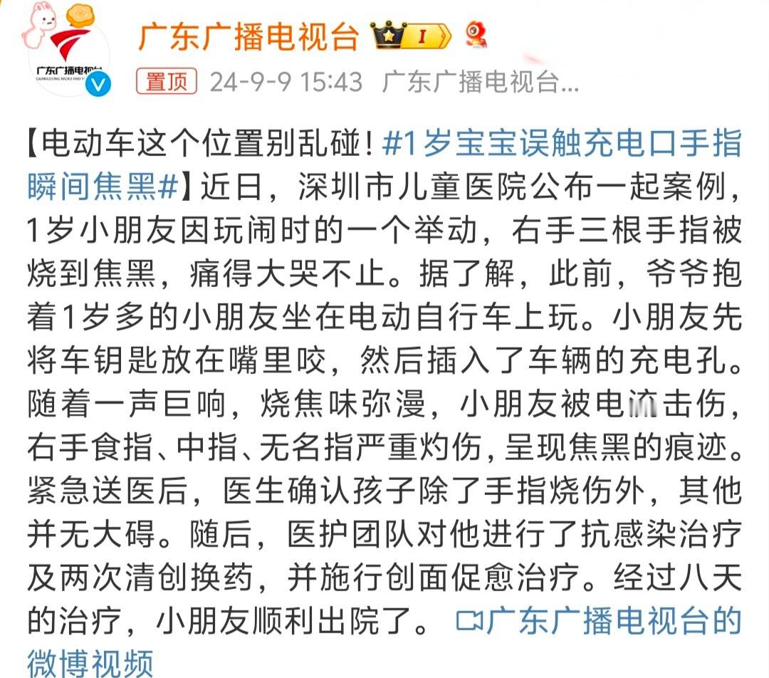 #1岁宝宝误触充电口手指瞬间焦黑# 充电线看着电流不大，但是家里有小朋友的也要小