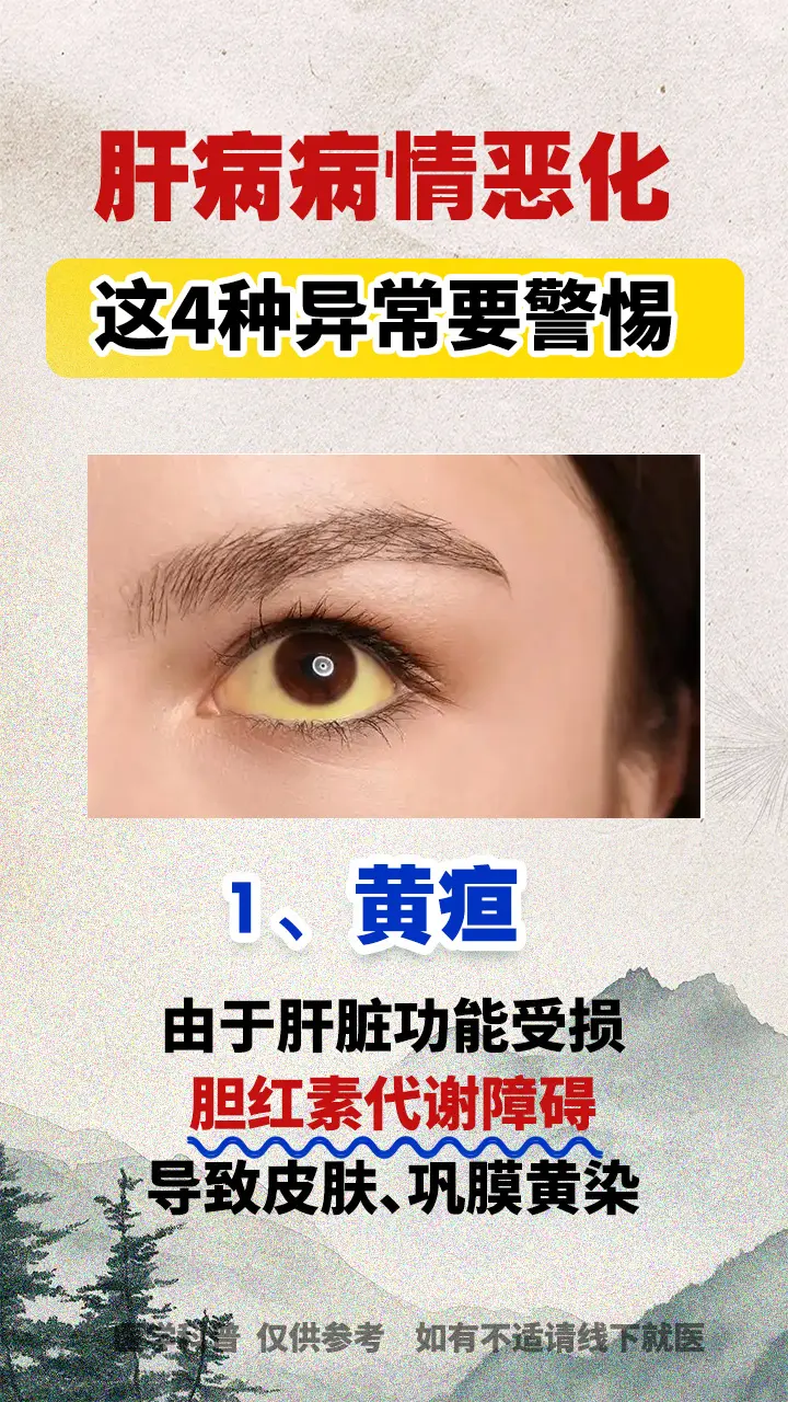 肝病症状 山东肝病医生阚晓 硬核健康科普行动 图文热点来了 健康热点