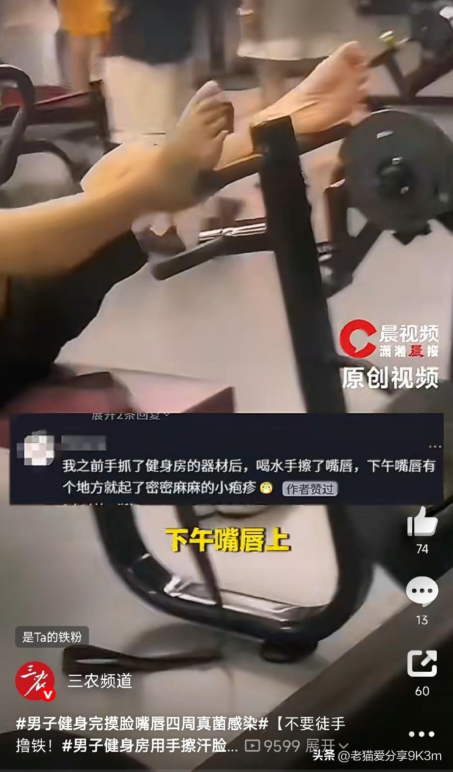 从没想过撸铁也能毁容！

广东一哥们用摸完器械的手擦了把脸，第二天嘴唇周围又红又