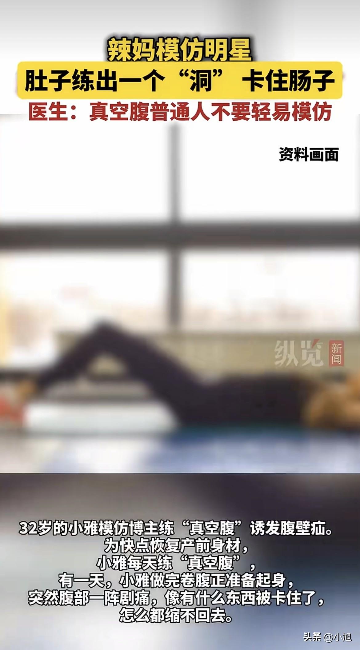 绝了！杭州32岁小雅，为了瘦肚子，每天吸肚子，硬生生把自己练出个“洞”，肠子从洞