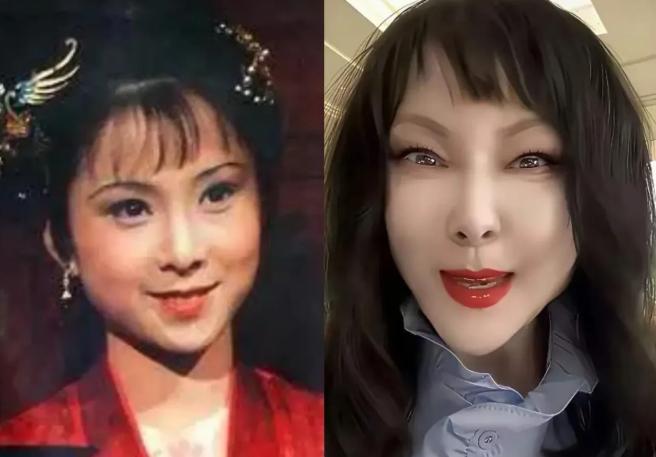 这居然是87版红楼梦的晴雯扮演者？她这张脸已经被医美毁了，成了典型的蛇精脸，吊梢