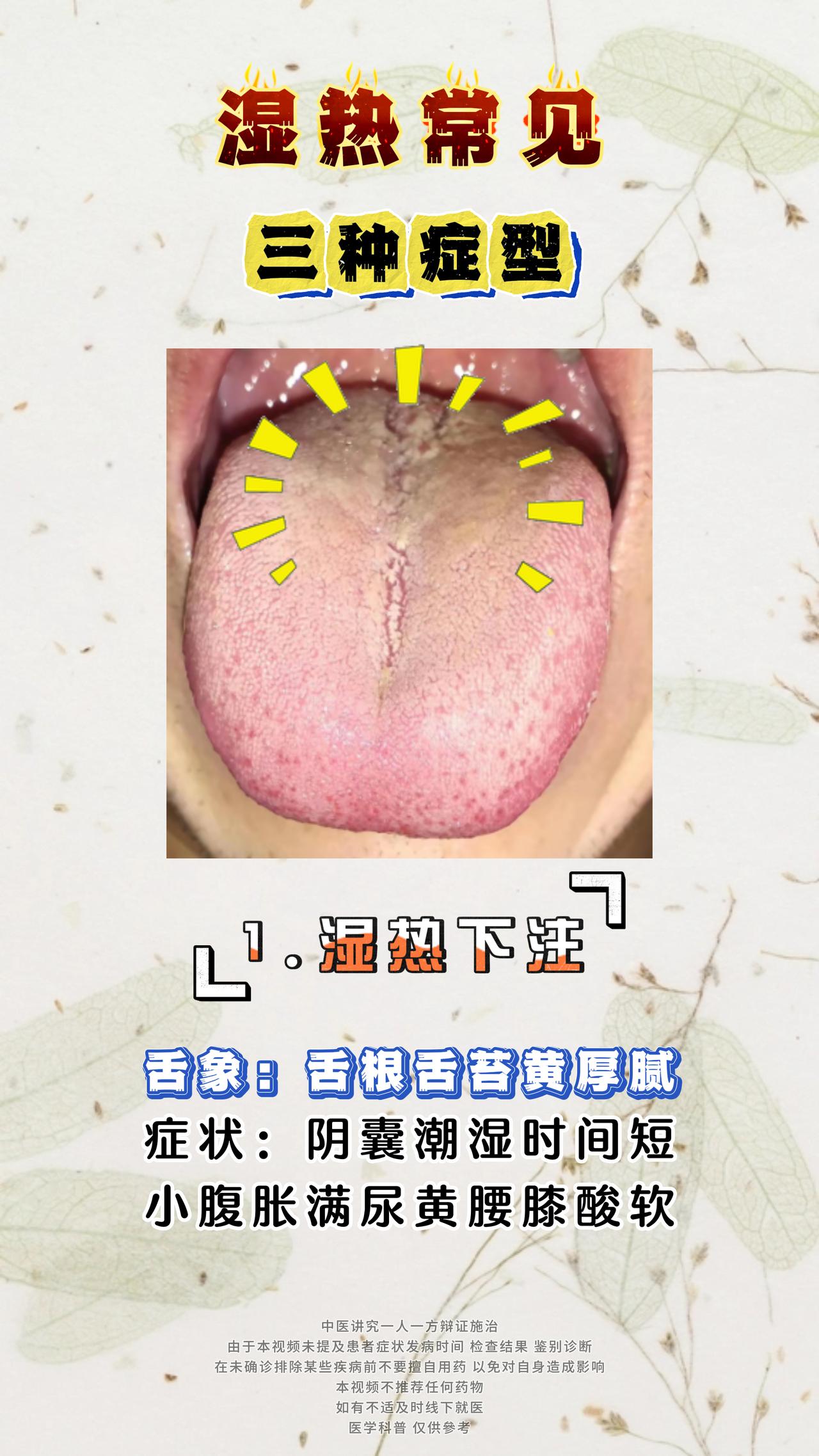 湿热不可怕，不懂才尴尬，3种湿热舌象，柴胡医生教你辨别#中医##男性健康#